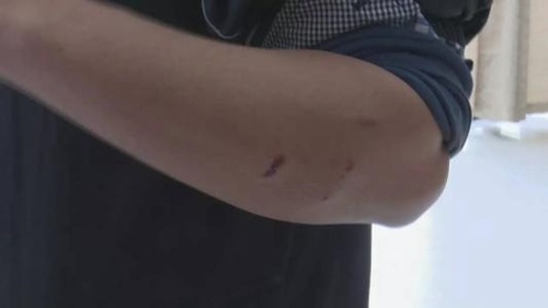 故意伤害轻伤一级能判多少